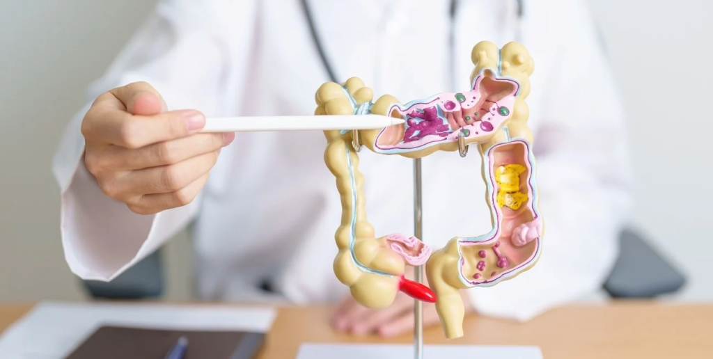 C&aacute;ncer de colon: el riesgo se duplica ante antecedentes familiares o mutaciones gen&eacute;ticas