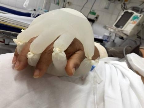 “La mano de Dios”, una emocionante técnica para internados con coronavirus creada por una enfermera