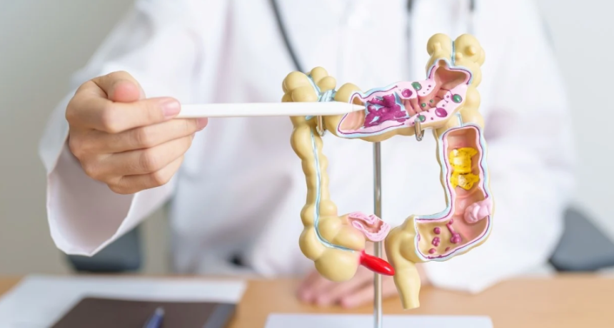 C&aacute;ncer de colon: el riesgo se duplica ante antecedentes familiares o mutaciones gen&eacute;ticas