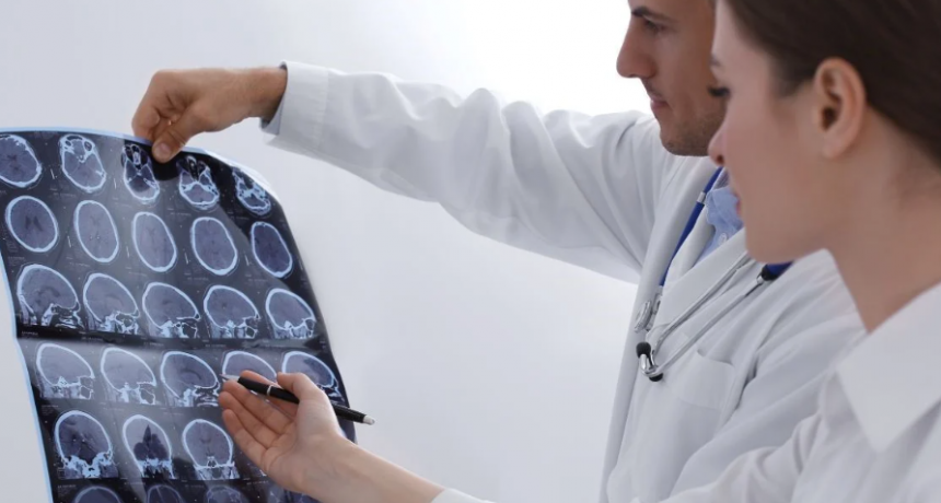 Esclerosis múltiple: una enfermedad crónica que afecta el sistema nervioso central