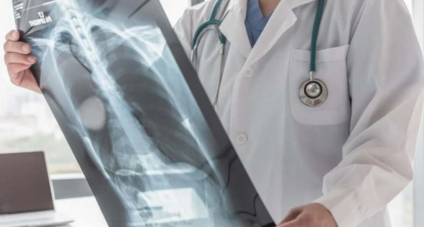 Avance en el tratamiento del cáncer de pulmón: disminución del 81% en la progresión