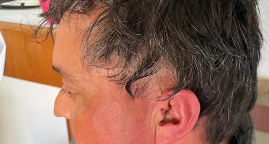 Feroz golpiza a un productor