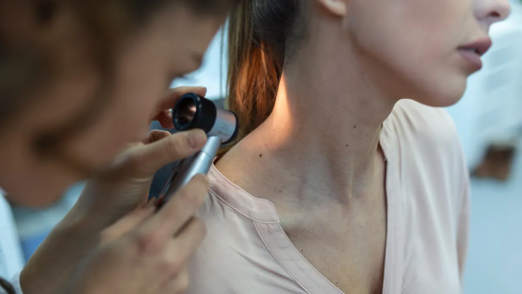 Vacuna para el melanoma: ya está disponible en Argentina la primera inmunoterapia nacional para cáncer de piel